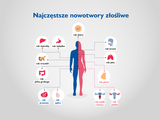 Najczęstsze rodzaje raka